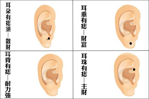 【女人耳朵上长痣】外耳轮长痣面相图 好的耳朵面相