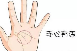 手上长痣怎么样 分析手掌有痣的人命理 第1张