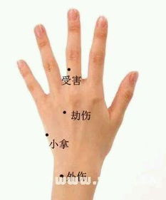 手掌痣相图解 男女手掌掌心有痣代表什么含义 第2张